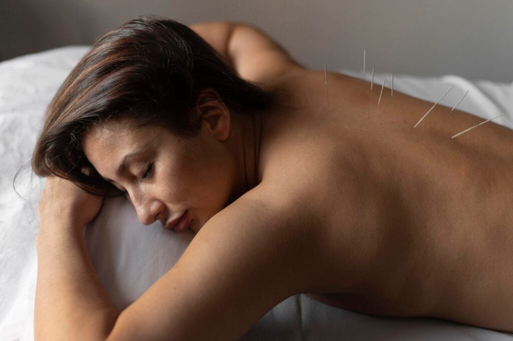 Fisioterapeuta aplicando punción seca en un paciente con dolor miofascial en Guadalajara